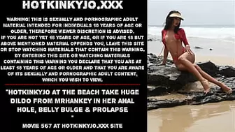 Hotkinkyjo at the beach take big dildo from mrhankey in her anal hole, belly bulge & prolapse